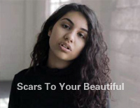 Scars To Your Beautiful-Alessia Cara钢琴谱文件(五线谱、双手简谱、数字谱、Midi、PDF)免费下载