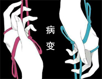 BINGBIAN病变钢琴谱文件（五线谱、双手简谱、数字谱、Midi、PDF）免费下载